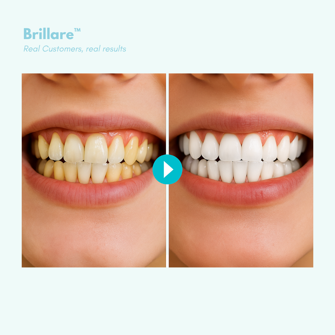 Brillare™ - Sip freely. Smile brightly.