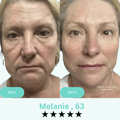 Lineology- - Say Goodbye to Your Double Chin