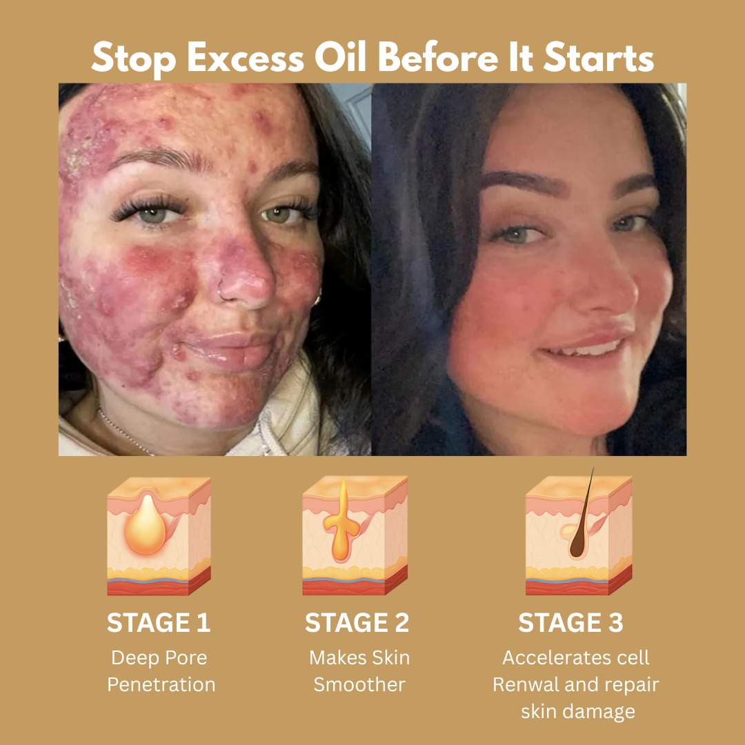 ADNOON 7-Day-One Skincare Cream