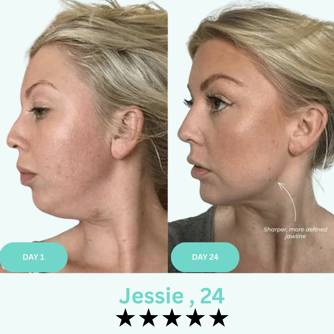 Lineology- - Say Goodbye to Your Double Chin