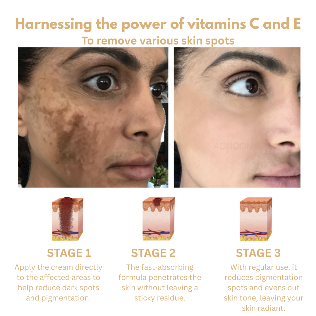 ADNOON 7-Day-One Skincare Cream