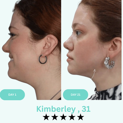 Lineology- - Say Goodbye to Your Double Chin