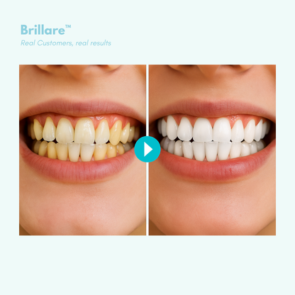 Brillare™  - Sip freely. Smile brightly.